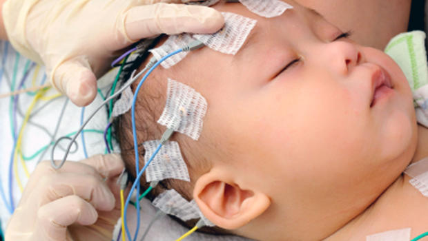 Bebek ve Çocuklar İçin EEG
