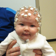 Bebeklere EEG Nasıl Çekilir?