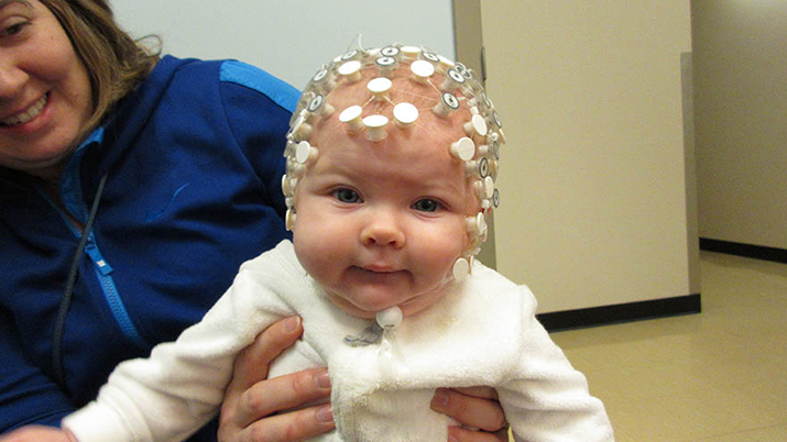 Bebeklere EEG Nasıl Çekilir?